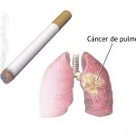 Al dejar de fumar reduces las posibilidades de contraer cáncer al pulmón